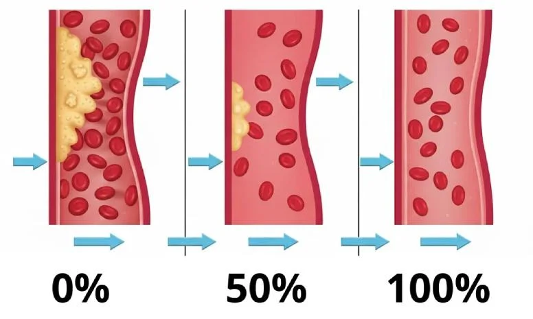 Evoluzione del flusso sanguigno nel pene: flaccido, semi-rigido ed erezione al 100%